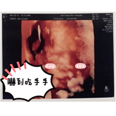 小虎妹妹終於來了