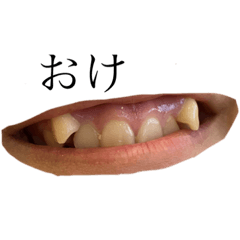 大原の八重歯