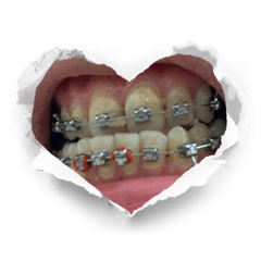 厚斗魚不洗頭喔耶