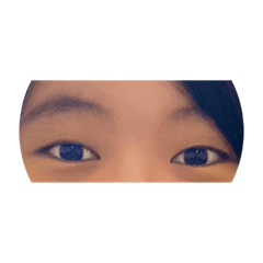 Eye20231112