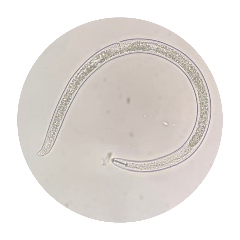 A lot of nematodes can be observed.