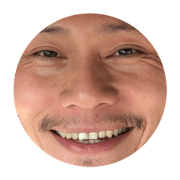 mengo
