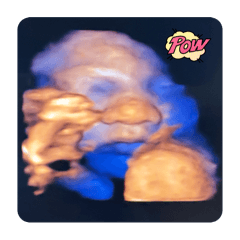 哈囉～我是可愛小籠包