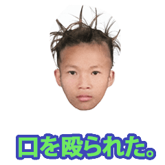 I got punched in the mouth.