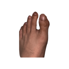 黃小丫