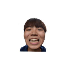 150593314