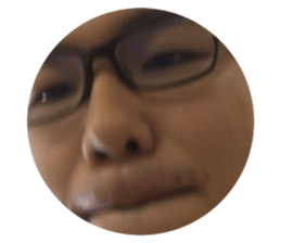 154917844