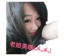 170894378