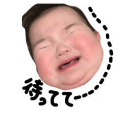 171451915