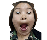 17704315
