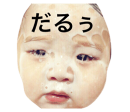 17977818