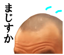 183151295
