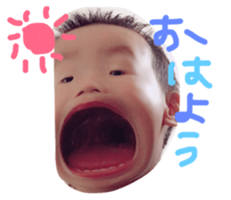 24676332