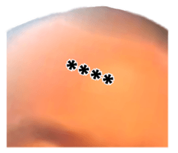251251332