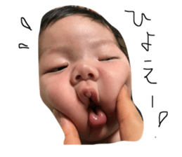28862693