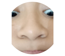 32443872