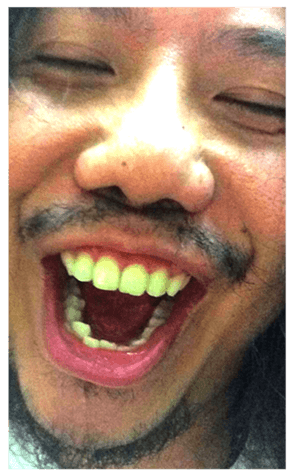 332083112