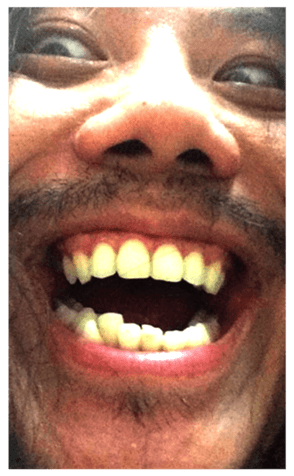 332083130