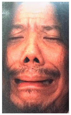332083136