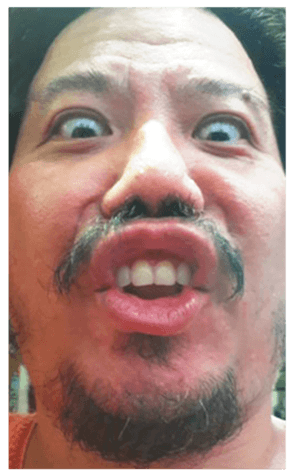 332083138