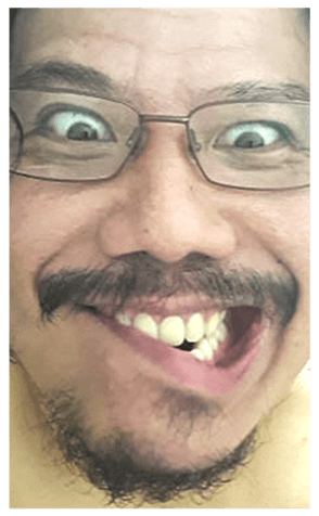 332083141