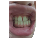381836238
