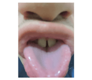 381836239
