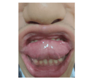 381836242