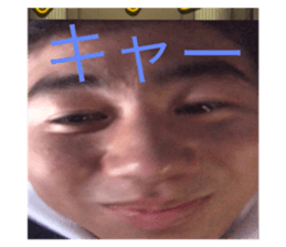 395927170