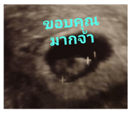 421146764