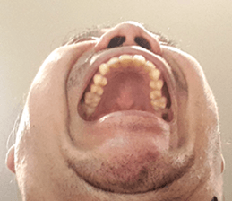 485402472