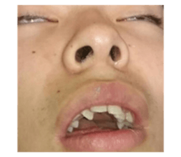 521309265