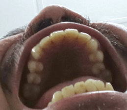 551084278