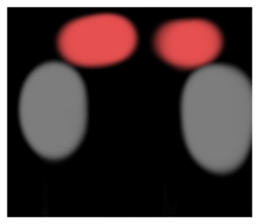 561992008