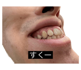 569182720