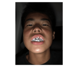605871692