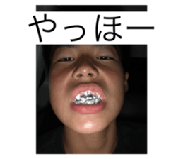 605871693