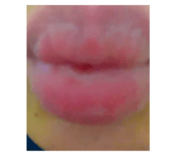 612008281
