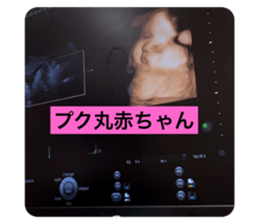 720156598