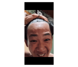 722016914