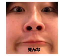 722019081