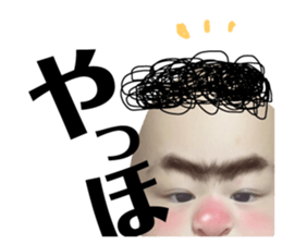 77627525