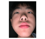 797239008