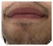 798021264