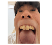 809326107