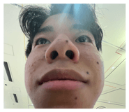 818749444