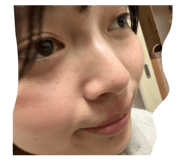 820151777