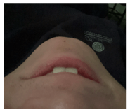 840690003