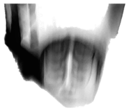 844415014