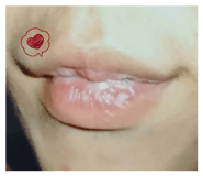 844828096